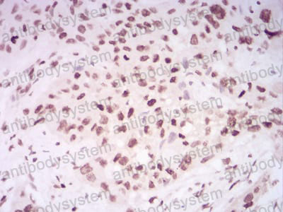 Валидация AntibodySystem RHF53206 (2560)