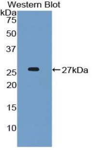 52170