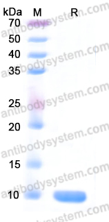 YHN45401, SDS-PAGE