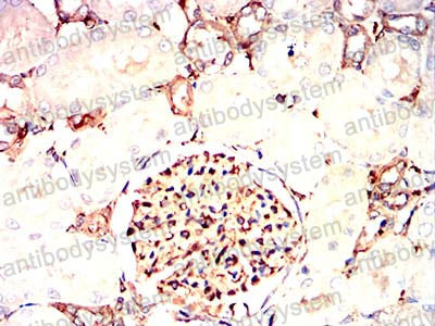 Валидация AntibodySystem RHN05103 (3787)