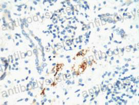 Валидация AntibodySystem RHH46701