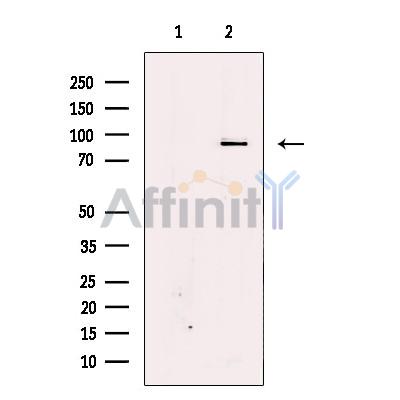 Валидация Affinity AF6293 - 3558