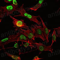 Валидация IF - AntibodySystem RHD99101