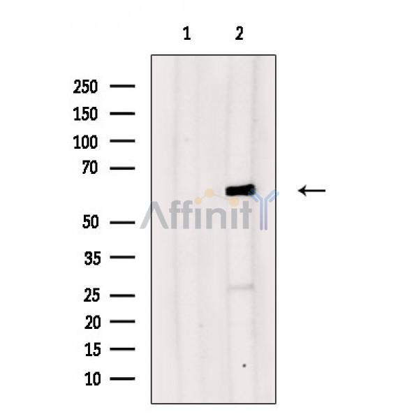 Валидация Affinity DF8171 - 20018