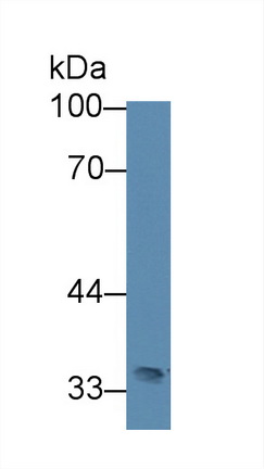 12381