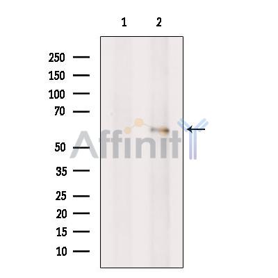 Валидация Affinity DF12113 - 6247