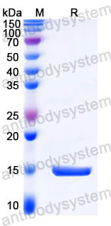 Валидация SDS-PAGE - AntibodySystem RZZ01824