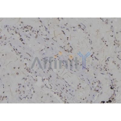 Валидация Affinity DF6947 - 18564