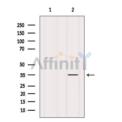 Валидация Affinity DF2468 - 13104