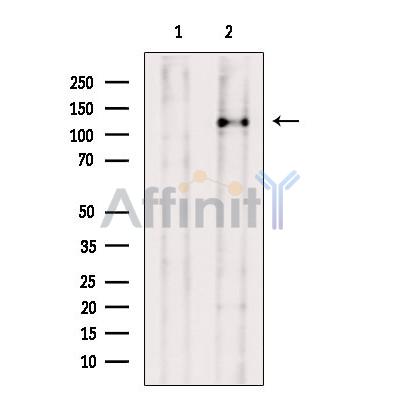 Валидация Affinity DF13744 - 9394