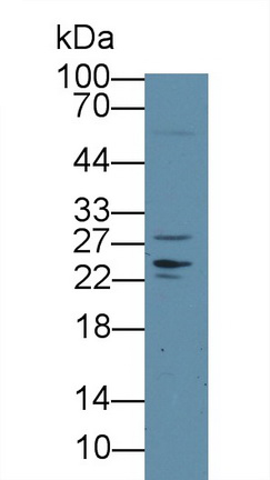 12767