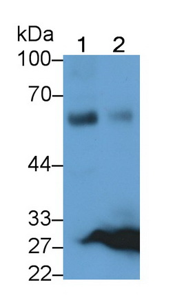 64701