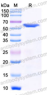EHC01601, SDS-PAGE
