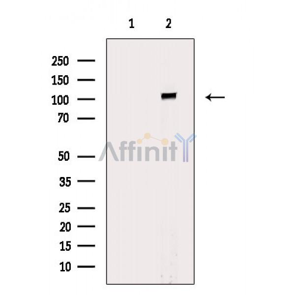 Валидация Affinity DF8585 - 20495