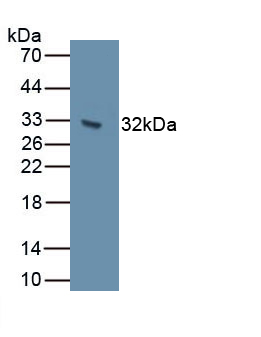62314