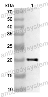 Валидация AntibodySystem PHA97401