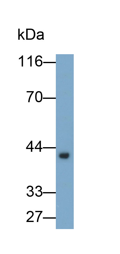 31670