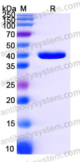 AHD17402, SDS-PAGE