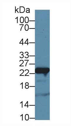 8556