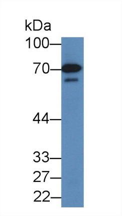 14957