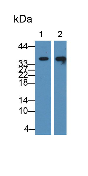 6315