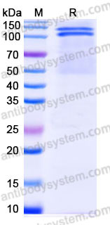 EHC95202, SDS-PAGE