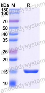 Валидация SDS-PAGE - AntibodySystem RVV03304