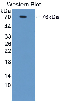 57237