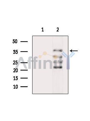 Валидация Affinity DF15101 - 11347
