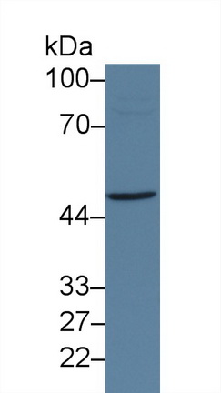 14215