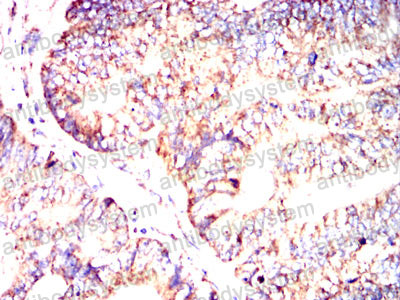 Валидация AntibodySystem RHC33503 (904)