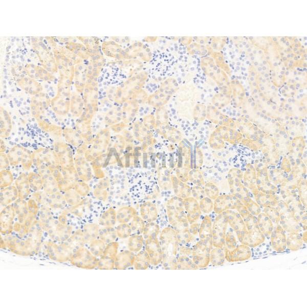 Валидация Affinity DF13651 - 9208