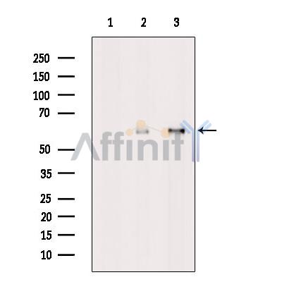 Валидация Affinity DF10041 - 5498