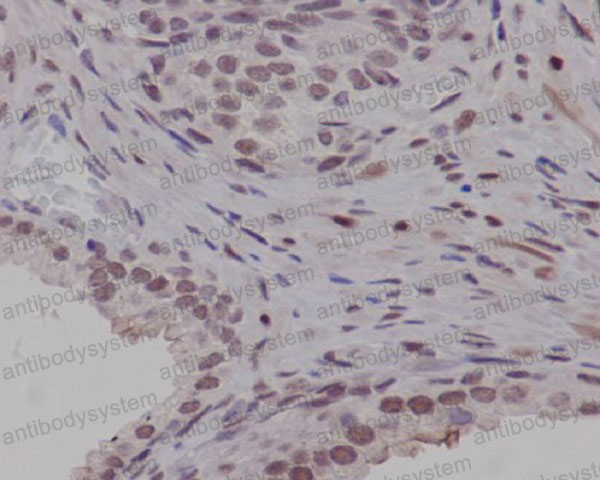 Валидация AntibodySystem RHC87901