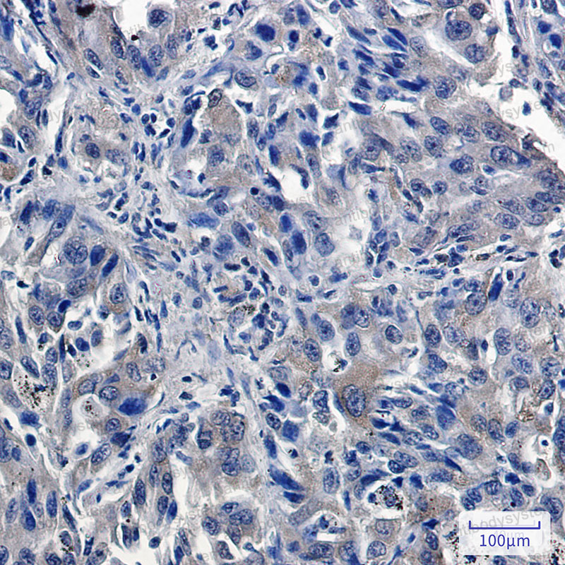 Валидация AntibodySystem RHJ35602