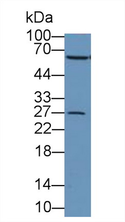9167