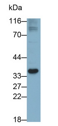 52582