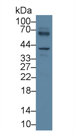 14716