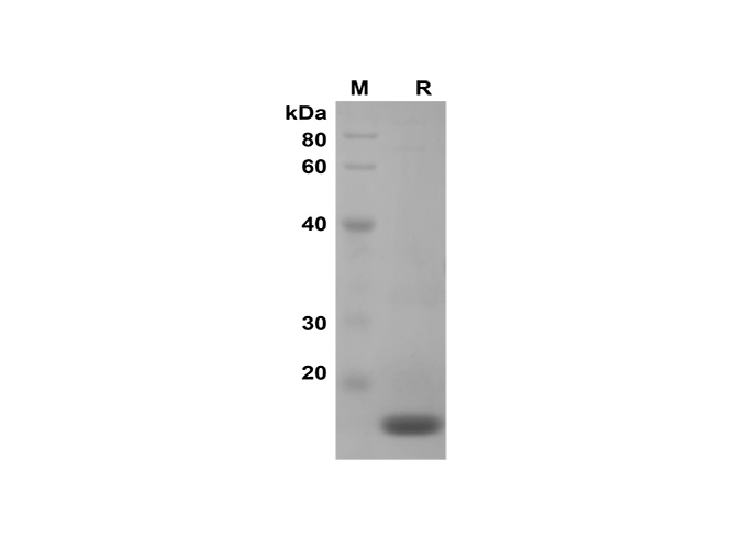 PDMM100235, электрофорез в ПААГ с ДСН