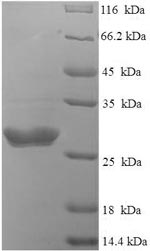SDS-PAGE