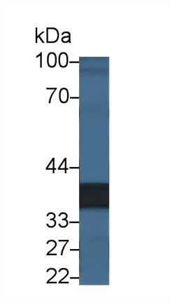 12515
