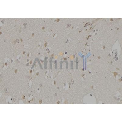 Валидация Affinity DF6312 - 17638