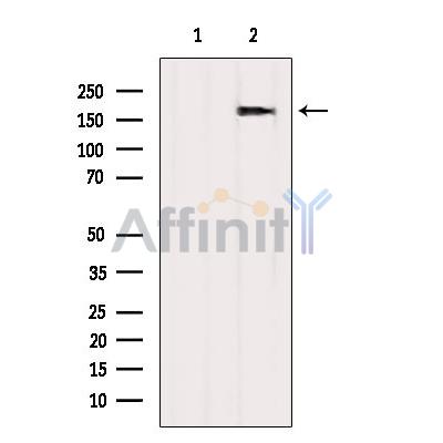 Валидация Affinity DF10026 - 5474