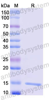Валидация SDS-PAGE - AntibodySystem RHB05702