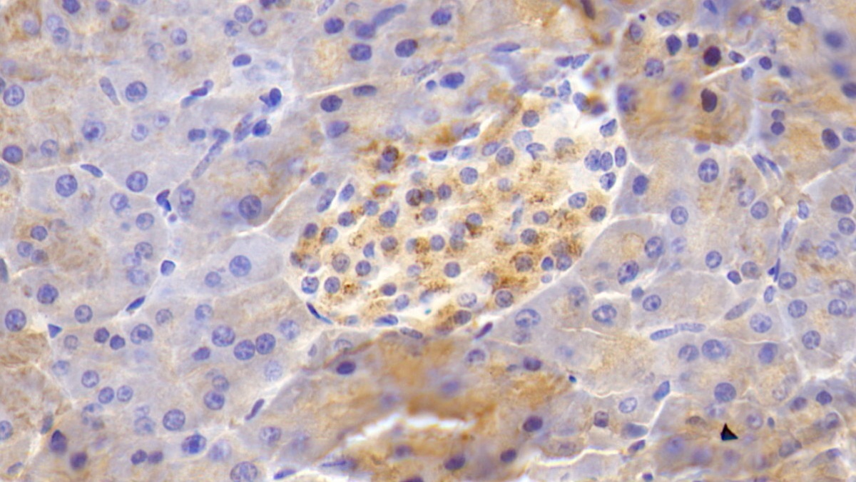 20185