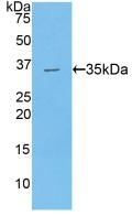 39577
