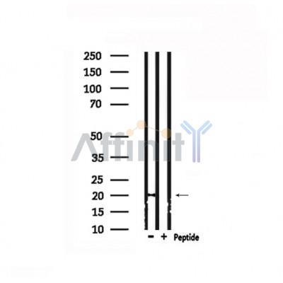 Валидация Affinity DF6170 - 17414