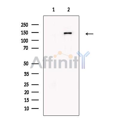 Валидация Affinity DF13452 - 8788