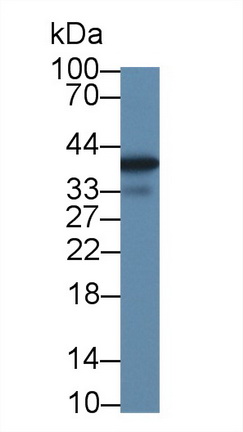 14197