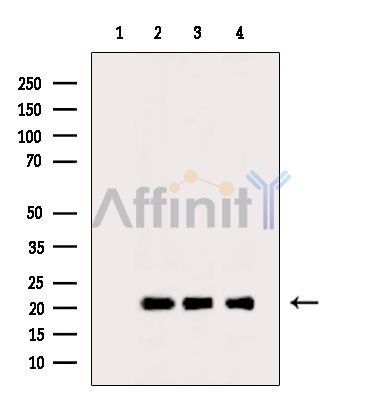 Валидация Affinity DF15535 - 11923